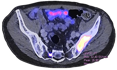 Fig. 4